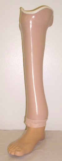 Partial Foot Prosthesis - Kiser's Orthotics And Prosthetics